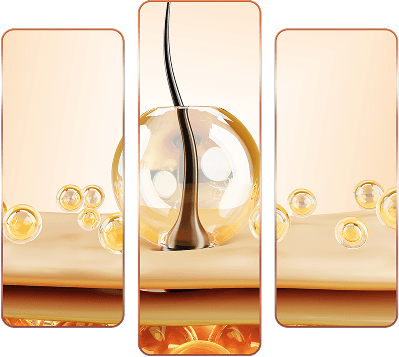 cấy ghép tóc y học quốc tế