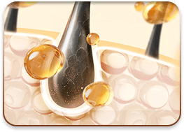 cấy ghép tóc y học quốc tế