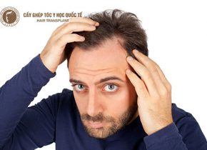 Cấy tóc chữ M có đau không?