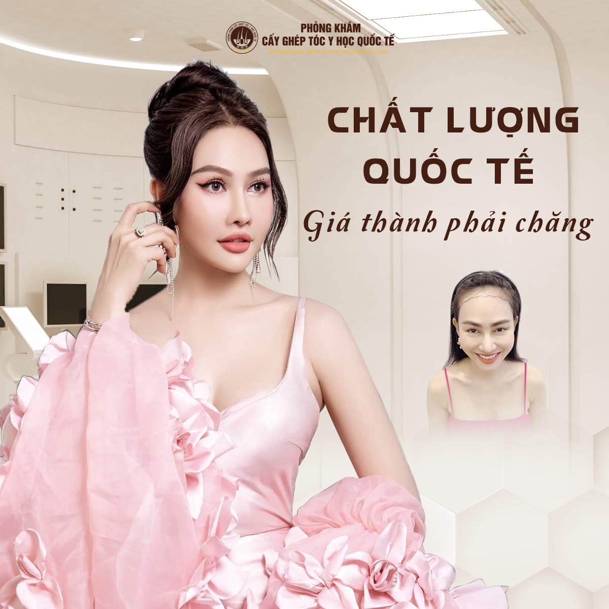 Hiểu rõ chi phí cấy tóc, cấy lông mày tại Cần Thơ: Đừng để “giá rẻ” khiến bạn trả “giá đắt”